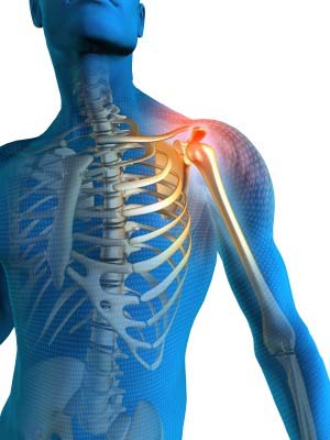 Shoulder Pain img