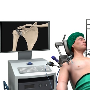 Shoulder Surgery