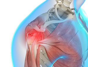 Shoulder Trauma img