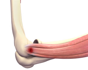 Sports Injuries-img