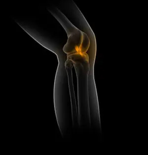What is Sports Medicine