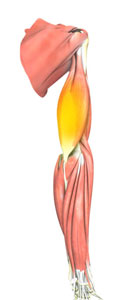 Triceps Tendonitis