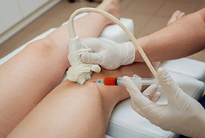 PRP for Knee Pain