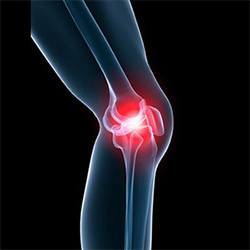 Picture of Knee Pain