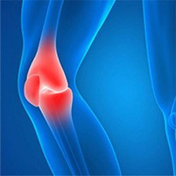 Picture of Sports Injuries