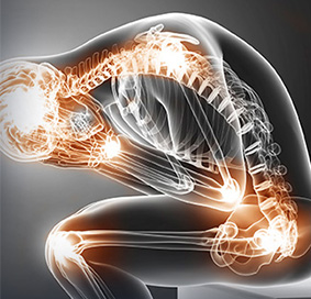 Relapsing Polychondritis 1