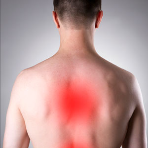 Inflammatory Myositis pic
