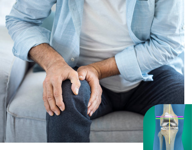 Kinematic Alignment Total Knee Arthroplasty icon