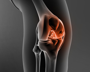 Cartilage Restoration img