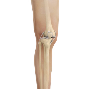 Knee Dislocation img
