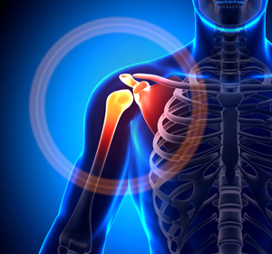 Shoulder Disorders img
