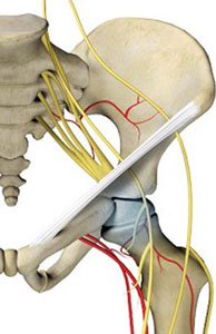 Avascular Necrosis pic