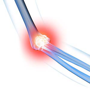 Elbow Pain pic