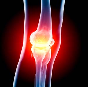 Knee Injury pic