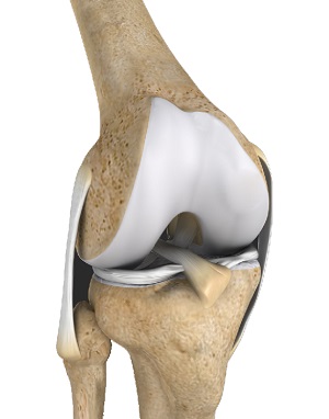 Multiligament Instability pic