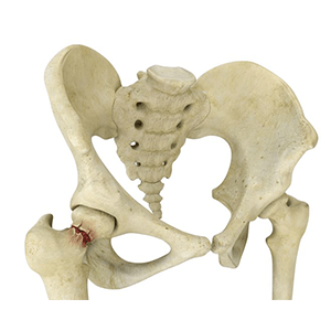 Orthopedic Trauma Surgery