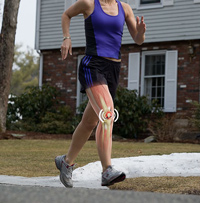Runner's Knee pic