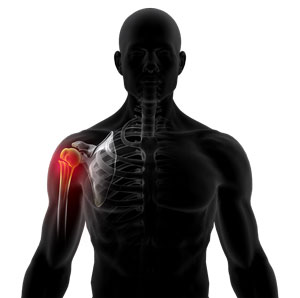 Shoulder Fracture Care pic