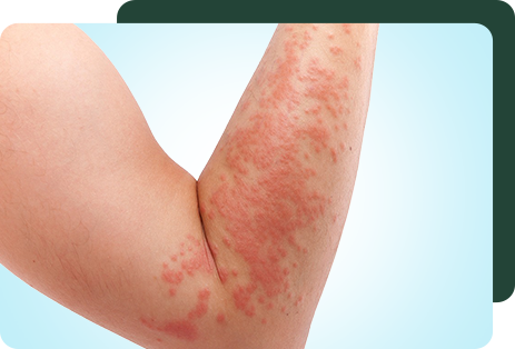 Conditions Commonly Evaluated