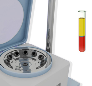 Platelet-Rich Plasma (PRP)