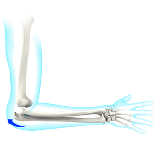 Elbow Dislocation
