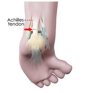 Pediatric Foot Conditions