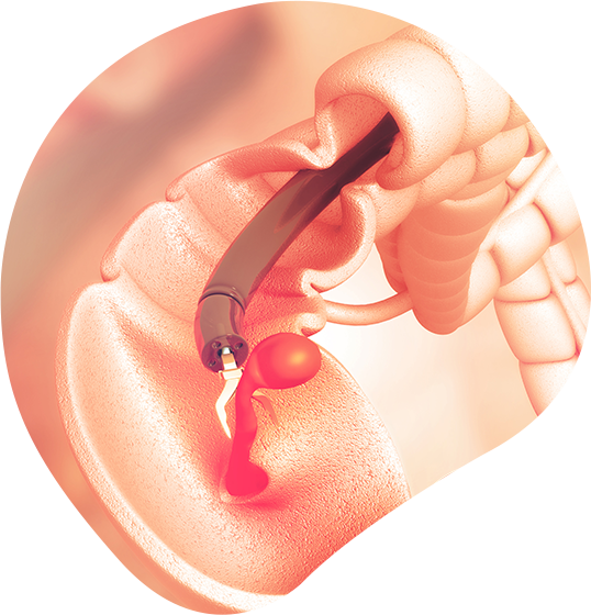 Advanced Procedures