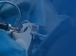 Arthroscopic Surgery