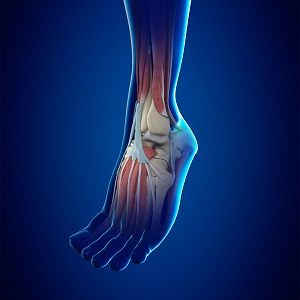 Ankle Stabilization