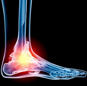 Foot Problems pic