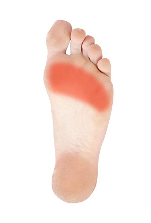 Forefoot Pain