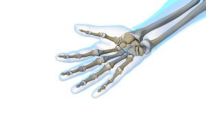 Hand and Wrist Sports Injuries