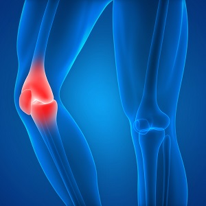 Knee Injury pic