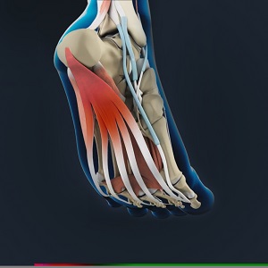 Plantar Fascia Release