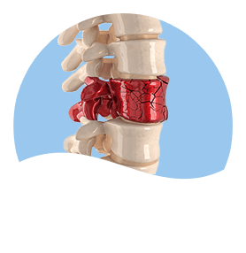 complex spinaltrauma Pic