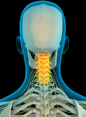 Cervical pic