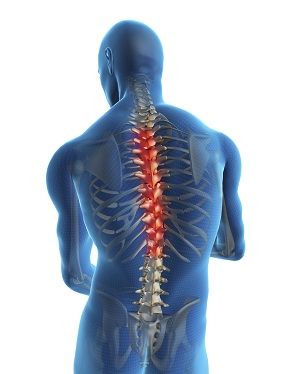 Thoracic pic