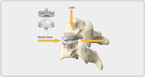 Mechanism of Action