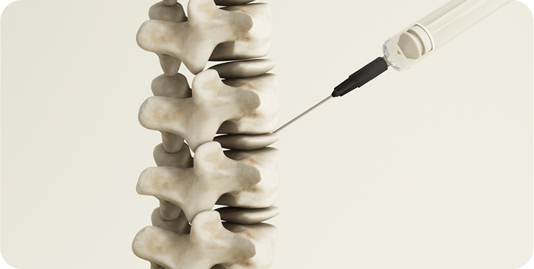 Nonoperative Spine Care Icon