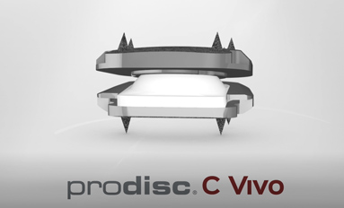 Prodisc C Vivo