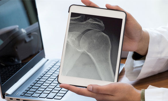 MRI & X-ray review
