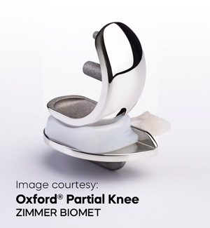 Oxford Unicompartmental Knee Replacement