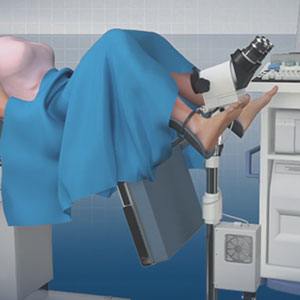 Picture of In-office Gynecologic Procedures