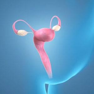 Picture of Menopausal Symptoms