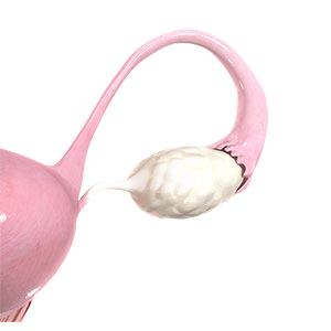 Picture of Ovarian Insufficiency