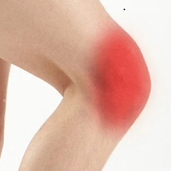Picture of Anterior Knee Pain