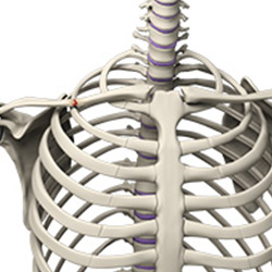 Picture of Clavicle Fracture