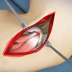 Picture of Elbow Anatomy