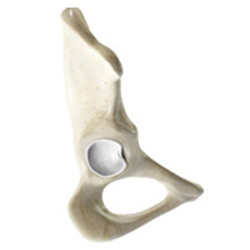 Picture of Hip Labral Tear