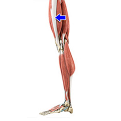 Picture of Iliotibial Band Lengthening